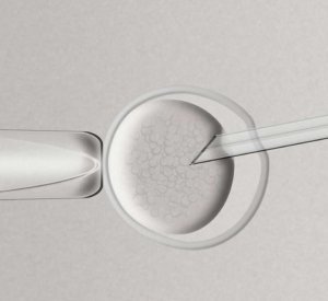 ICSI – Intracytoplasmic Sperm Injection